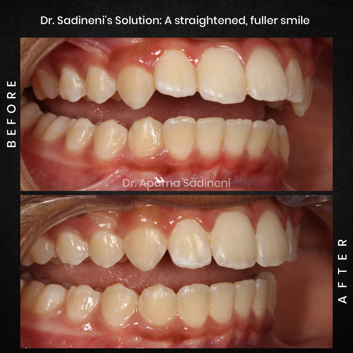 DMD-NOV-GRID-3-POST-5-HEADSHOT-B_A-ARUSH_3-1